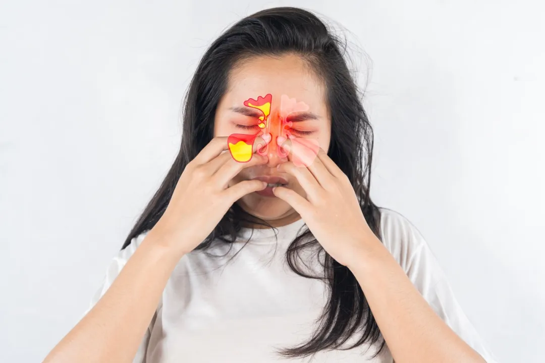 鼻窦炎.png